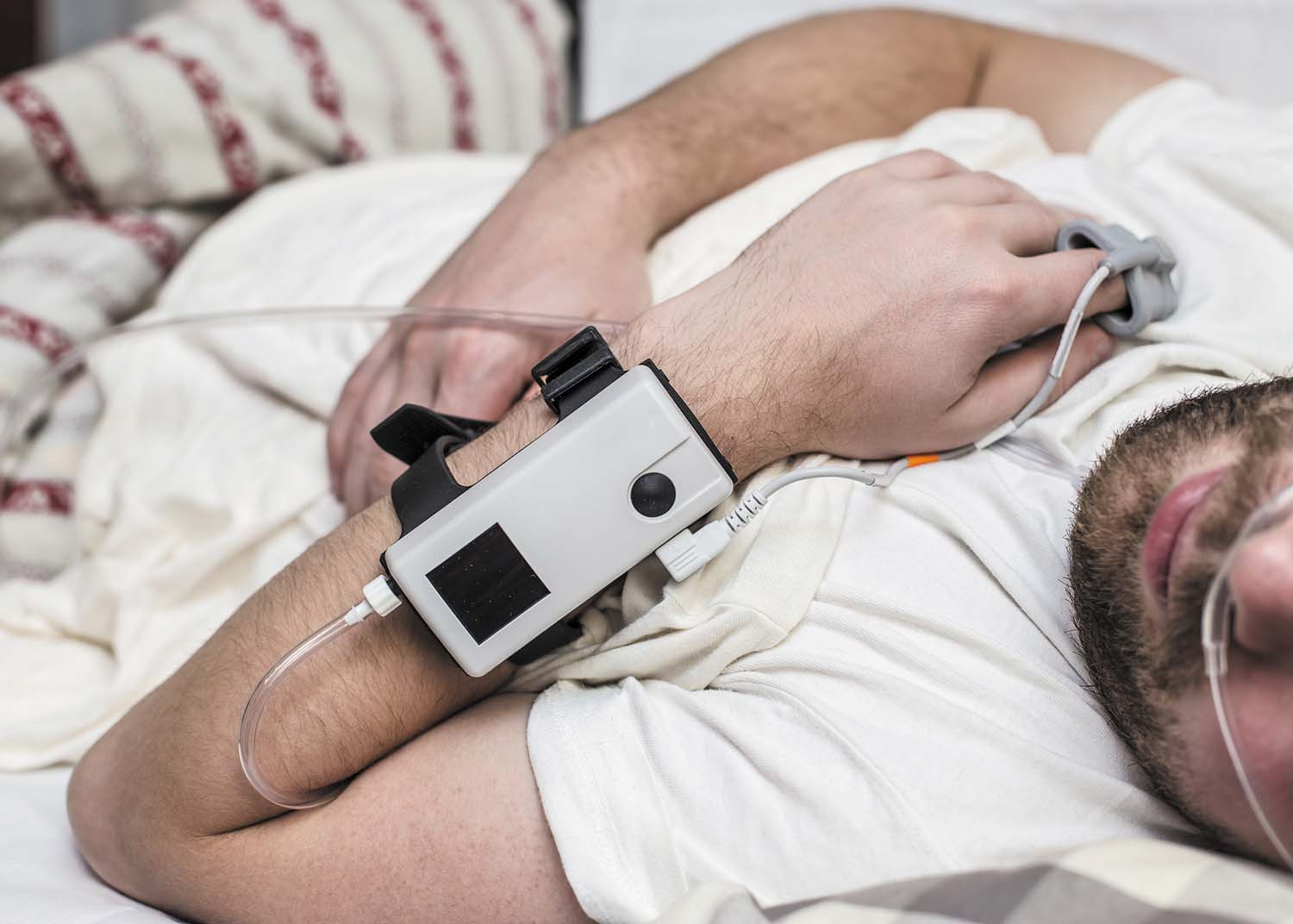 Sleep Apnea