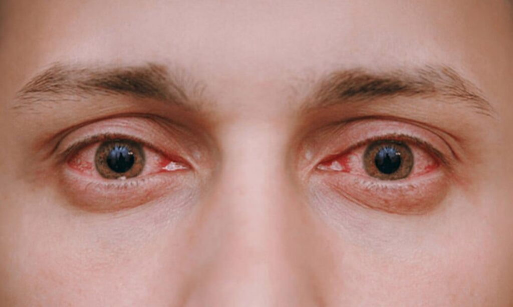 Understanding Retinal Diseases: Symptoms, Causes, and Treatments